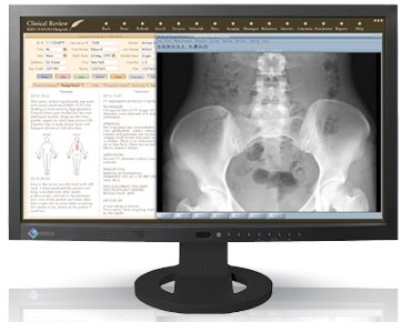 3,000：1の高コントラスト比を実現した23インチフルHD液晶、EIZO「RadiForce MS230W」