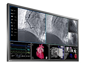 EIZO、手術室向け高解像度8メガピクセル対応58型モニタ「RadiForce LS580W」