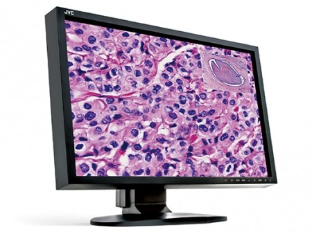 複数台間で色空間が共有できる病理用画像向け24.1型液晶、JVCケンウッド「JD-C240」