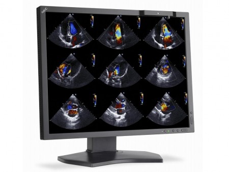 米NEC Display、キャリブレーションセンサー内蔵の医用向け21.3インチ液晶「MultiSync MDC212C2」