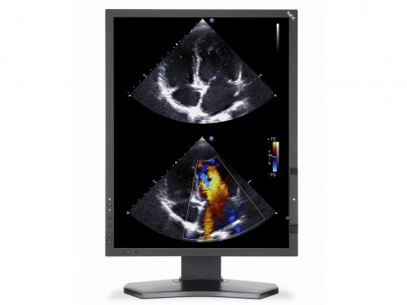 米NEC Display、キャリブレーションセンサー内蔵の医用向け21.3インチ液晶「MultiSync MDC212C2」
