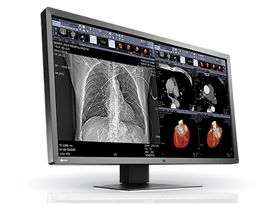 EIZO、8メガピクセル対応の31.1型医用ディスプレイ「RadiForce MX315W」