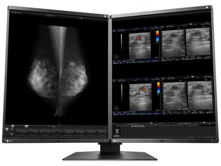 5メガ液晶を2枚搭載する医科用ディスプレイシステム、EIZO「RadiForce