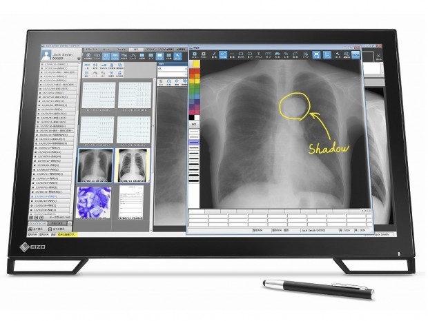 手書き入力対応の医用23型ワイド液晶、EIZO「RadiForce MS236WT