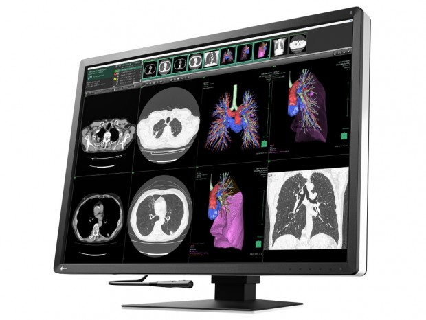 解像度4,200×2,800ピクセルの30.9型医用ディスプレイ、EIZO「RadiForce RX1270」