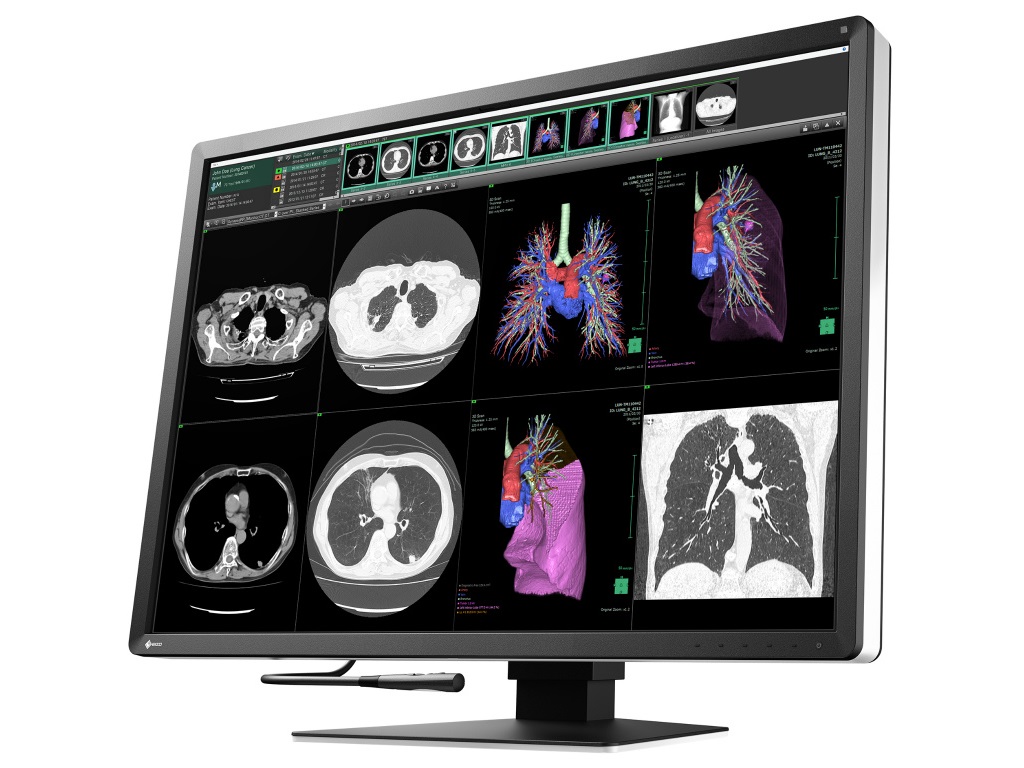 EIZO RadiForce RX440 液晶モニタ29.8 使用时间4874H RadiForce RX440 | EIZO