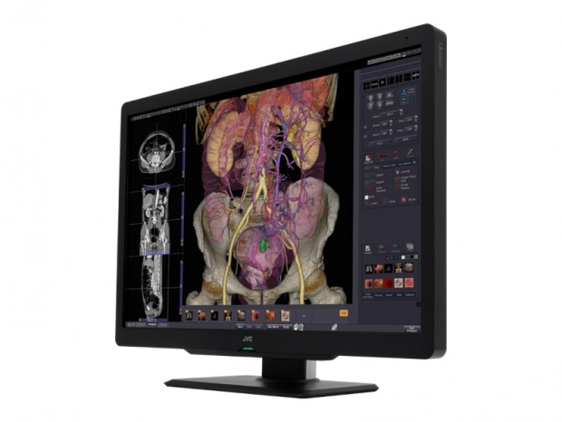JVC、解像度3,280×2,080ドットの30型医用液晶ディスプレイ「CL-S600」