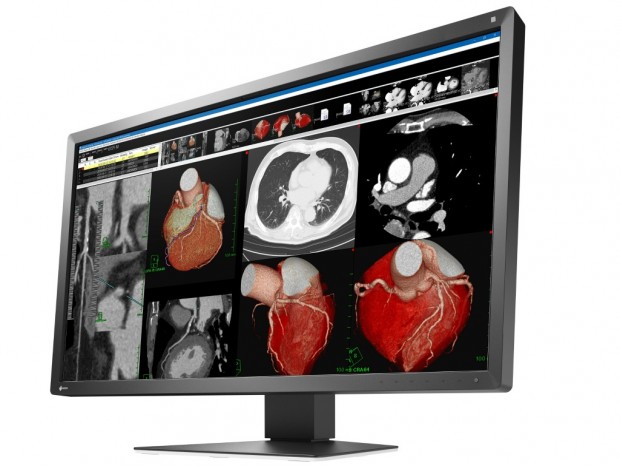 最大94W給電のUSB Type-C搭載30.5型医用ディスプレイ、EIZO「RadiForce MX317W」
